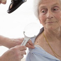 A woman receiving skin cancer services near Kinston, SC